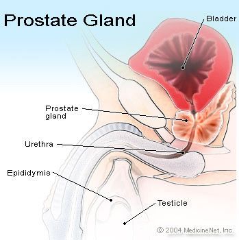 prostate gland cancer