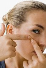 Causes of pimples