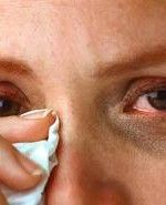 burning sensation in eyes burning sensation in eyes