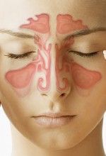 sinus problem prevention during winters sinus problem prevention during winters