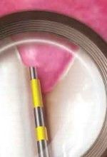 oral cancer causes and prevention