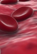 haemophilia causes and symptoms
