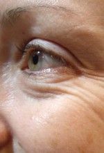 tips to prevent early wrinkles tips to prevent early wrinkles