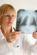 Peritoneal mesothelioma symptoms and treatment