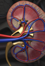 Kidney stone symptoms and home remedies