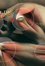 Neuropathic pain