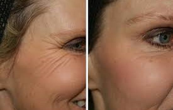 Look 10 Years Younger Naturally: Secret Facial Mask Look 10 Years Younger Naturally: Secret Facial Mask